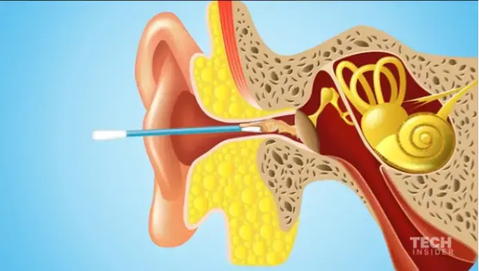 Wireless visual ear canal cleanser endoscope